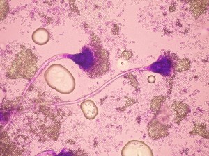 Hifes fúngiques i conidis al microscopi / Hifas fúngicas y conídios al microscopio
